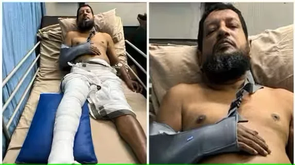 കാട്ടുപന്നി കുറുകെ ചാടി; സ്കൂട്ടറിൽ നിന്നു വീണ യാത്രക്കാരന് പരിക്ക്