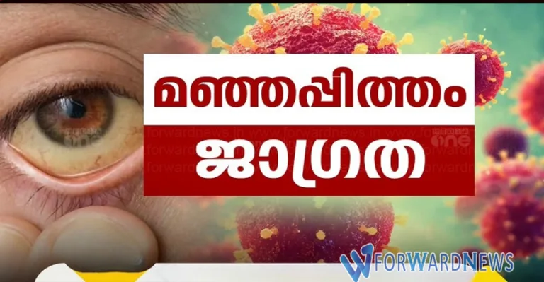 മഞ്ഞപ്പിത്തം മുതിർന്നവരിൽ ഗുരുതരമാകാൻ സാധ്യതയേറെ