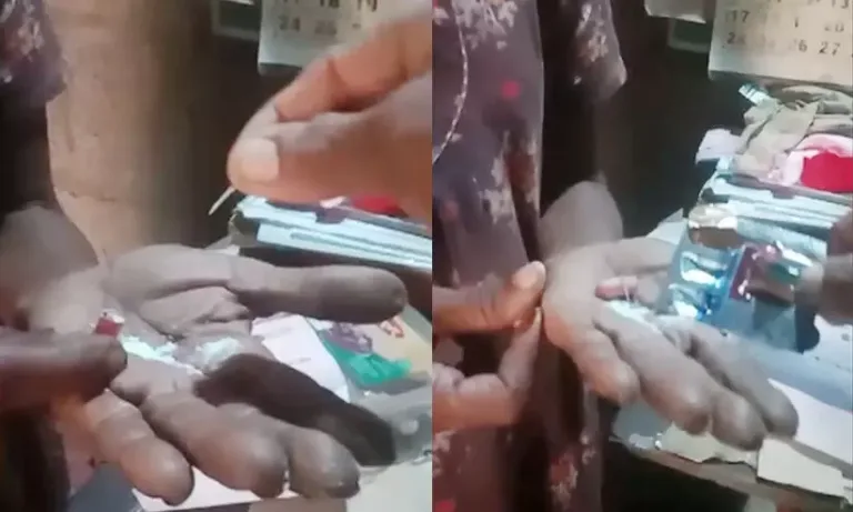 ശ്വാസതടസ്സത്തിന് രോഗിക്ക് നൽകിയ ഗുളികയിൽ മൊട്ടുസൂചി!
